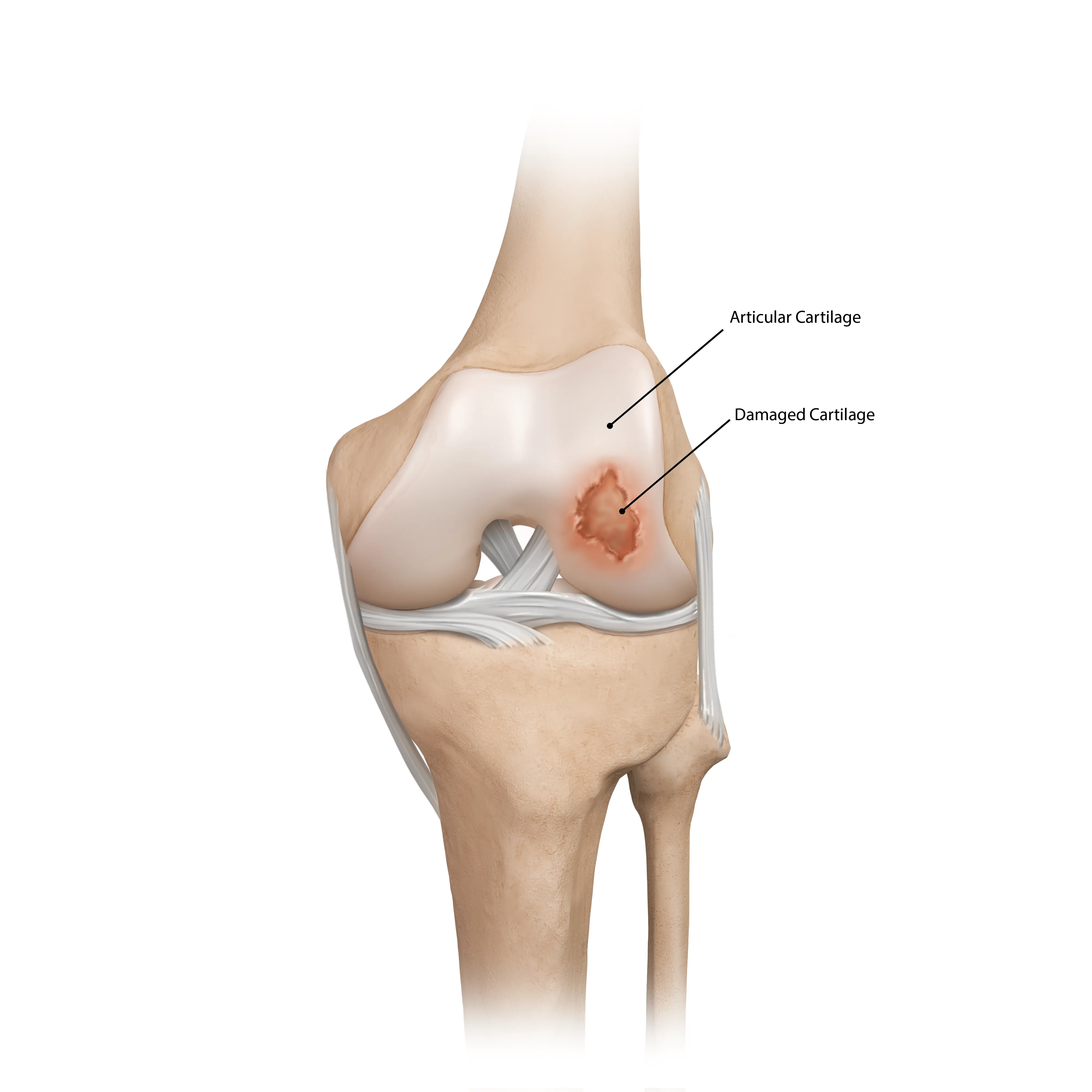 Arthrex Joint Preservation | Home